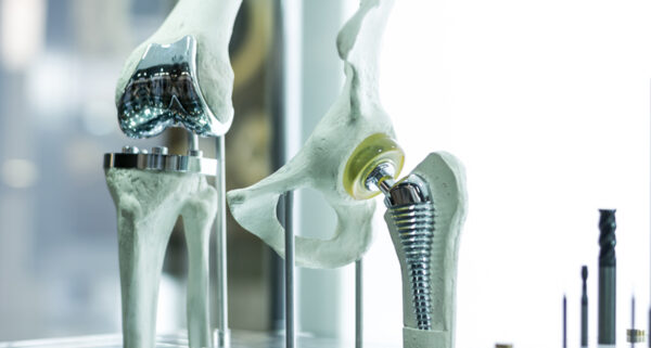 Key considerations for enhancing orthopaedic implants inspection