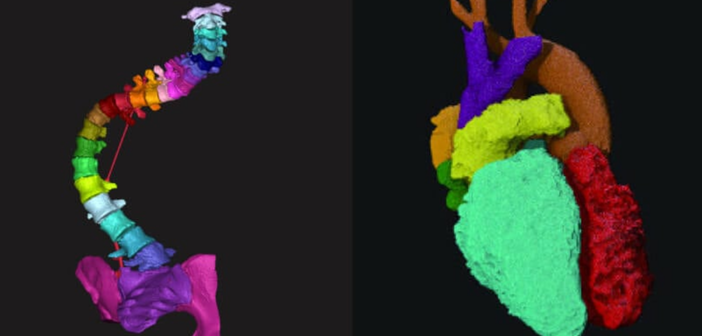 Medical Image Segmentation