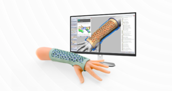 Digital workflows in orthotics & prosthetics easier than ever
