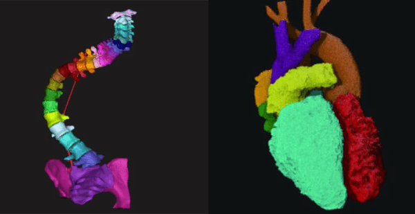 How digital manufacturing tools are enabling growth in patient-specific design